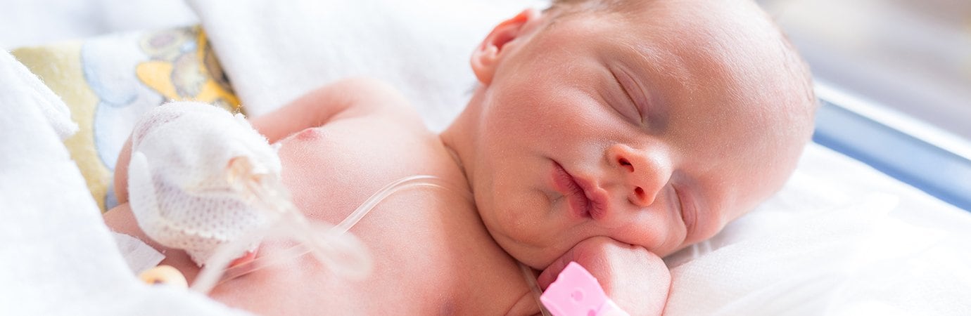 Newborn baby in a level II nursery 